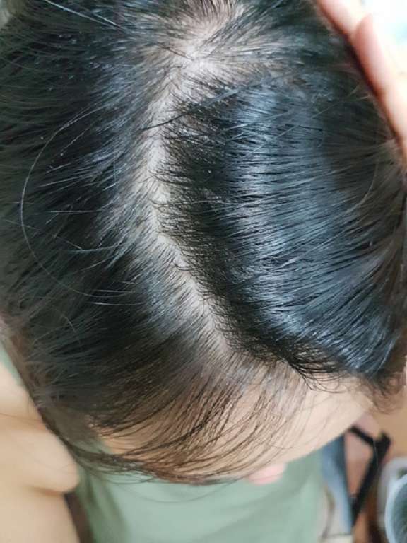 Charm卉紅生技頭皮護理精萃