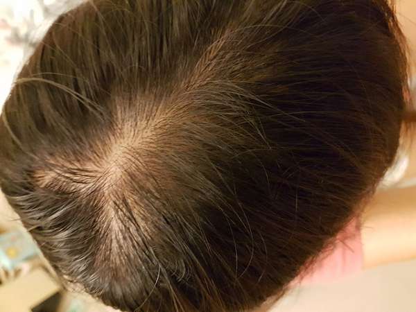 Charm卉紅生技頭皮護理精萃