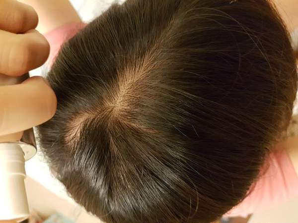 Charm卉紅生技頭皮護理精萃