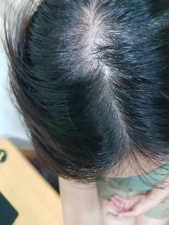 Charm卉紅生技頭皮護理精萃