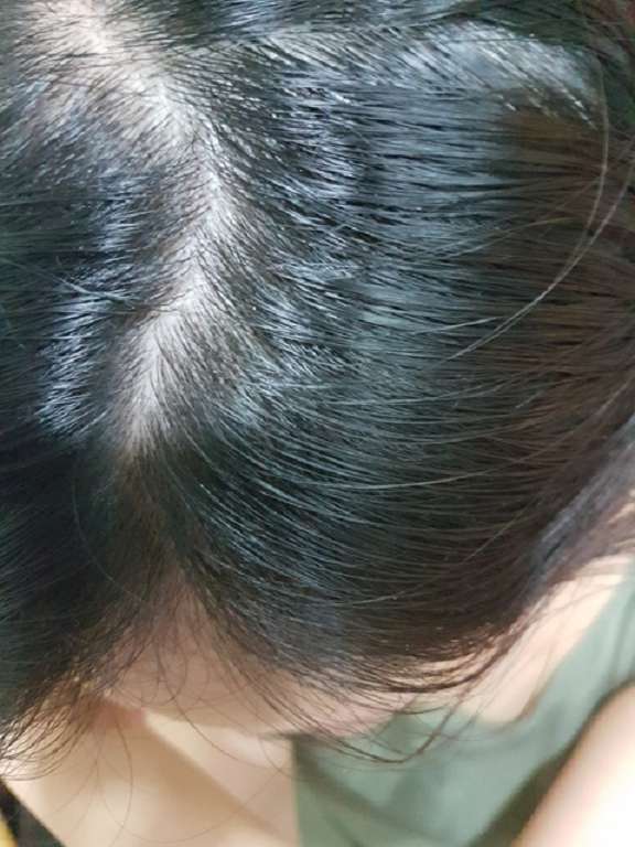 Charm卉紅生技頭皮護理精萃