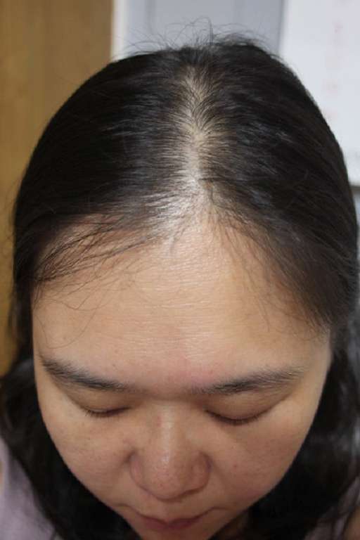 Charm卉紅生技頭皮護理精萃