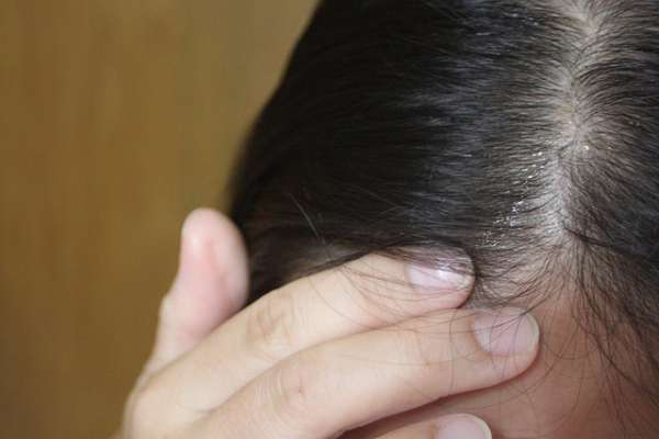 Charm卉紅生技頭皮護理精萃