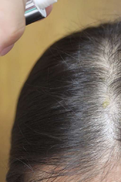 Charm卉紅生技頭皮護理精萃