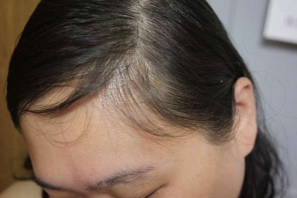 Charm卉紅生技頭皮護理精萃