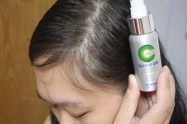 Charm卉紅生技頭皮護理精萃