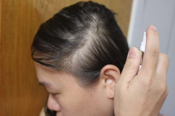 Charm卉紅生技頭皮護理精萃