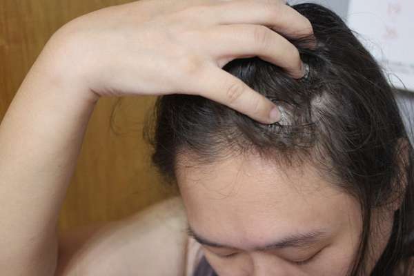 Charm卉紅生技頭皮護理精萃