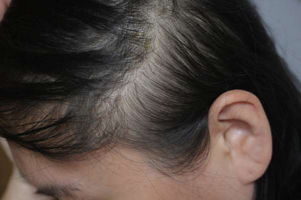 Charm卉紅生技頭皮護理精萃