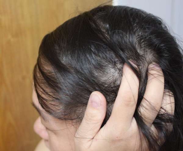 Charm卉紅生技頭皮護理精萃