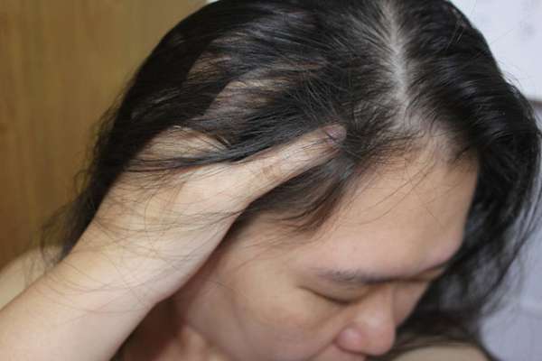 Charm卉紅生技頭皮護理精萃