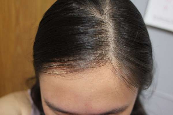 Charm卉紅生技頭皮護理精萃