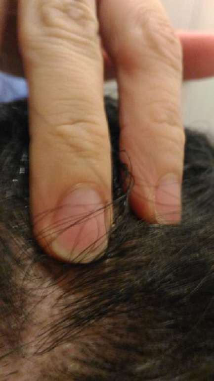 Charm卉紅生技頭皮護理精萃