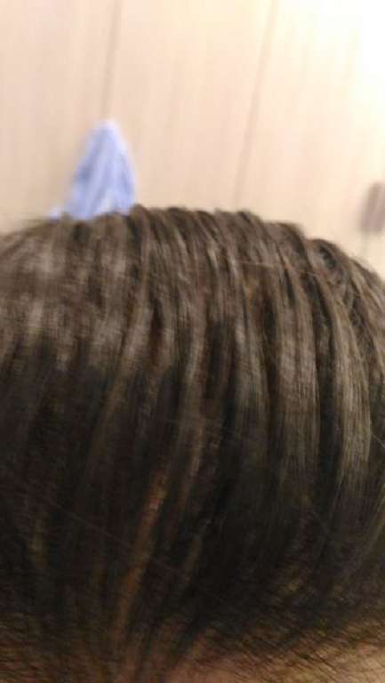 Charm卉紅生技頭皮護理精萃