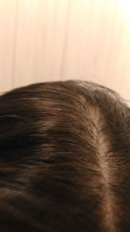 Charm卉紅生技頭皮護理精萃