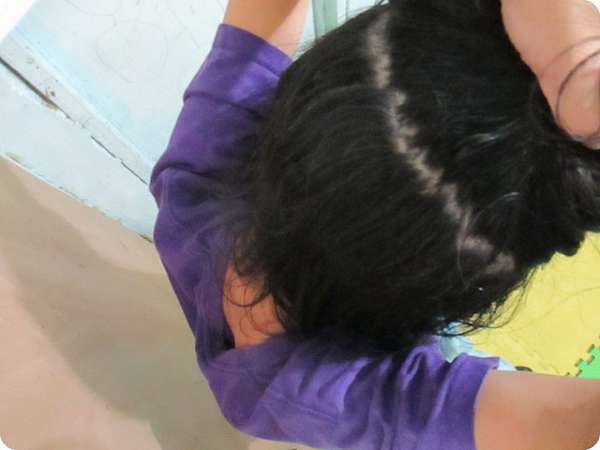 Charm卉紅生技頭皮護理精萃