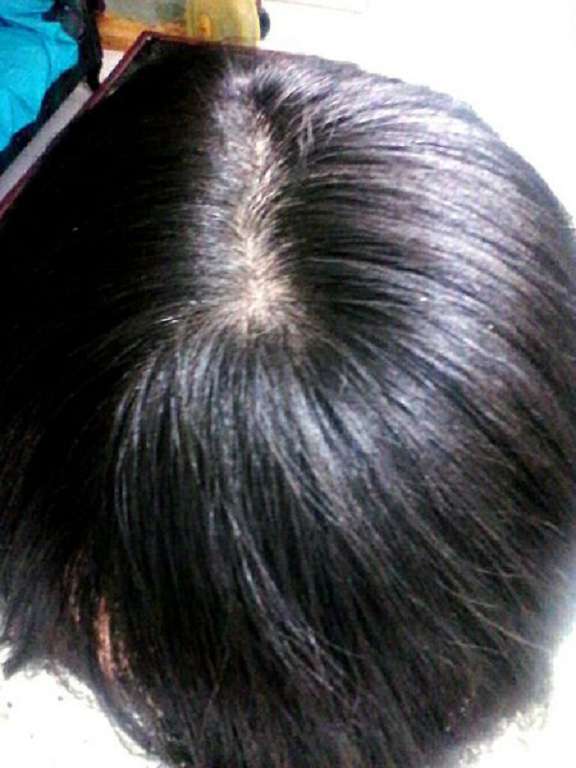 Charm卉紅生技頭皮護理精萃