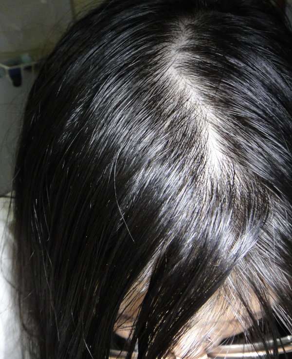 女人 知己 試用 大隊 Charm 卉紅 生技 頭皮 護理 精萃 掉頭髮 頭皮出油 髮量少 頭皮痛 頭皮長痘痘 圓形禿 雄性禿 頭髮變細 髮量少露出頭皮 脂漏性毛囊炎 染髮後頭皮發炎 chialo