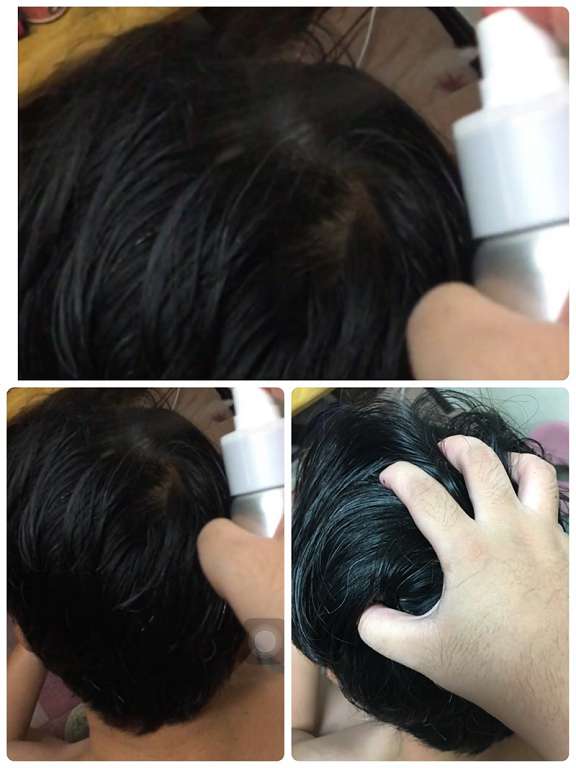 Charm卉紅生技頭皮護理精萃