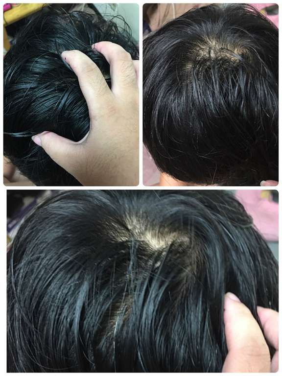 Charm卉紅生技頭皮護理精萃