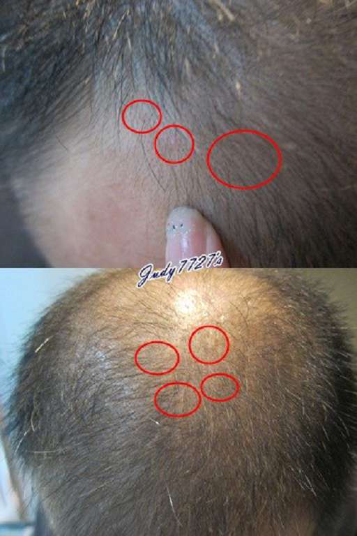 Charm卉紅生技頭皮護理精萃