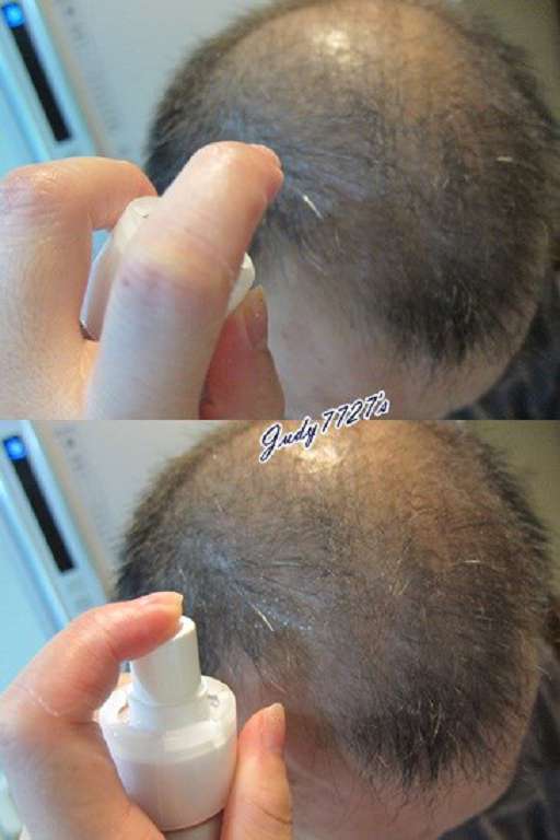 Charm卉紅生技頭皮護理精萃