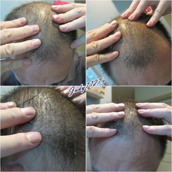 Charm卉紅生技頭皮護理精萃