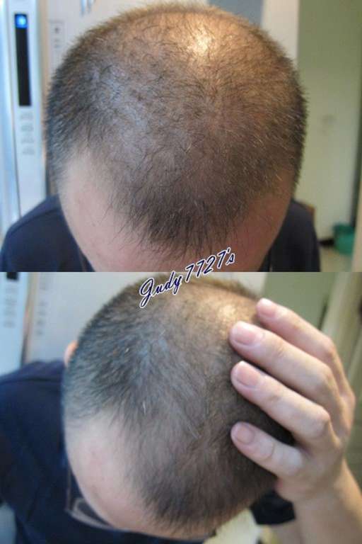 Charm卉紅生技頭皮護理精萃