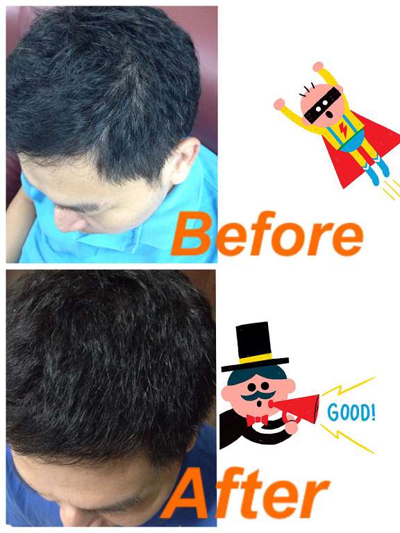 Charm卉紅生技頭皮護理精萃