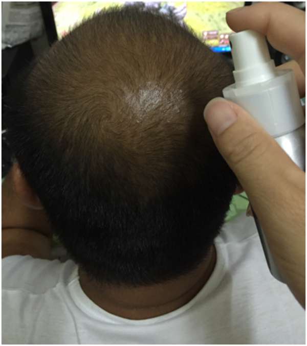 Charm卉紅生技頭皮護理精萃