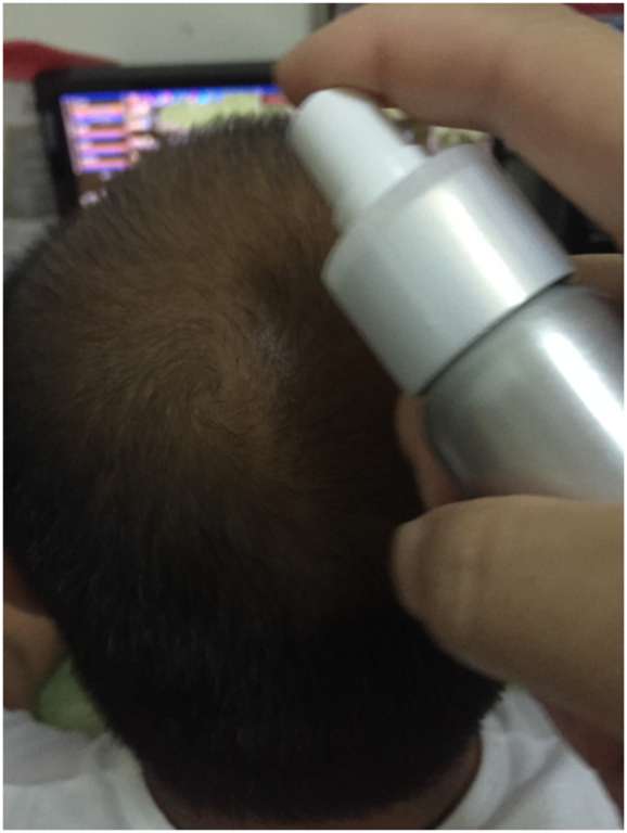 Charm卉紅生技頭皮護理精萃