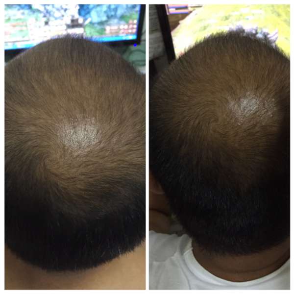 Charm卉紅生技頭皮護理精萃