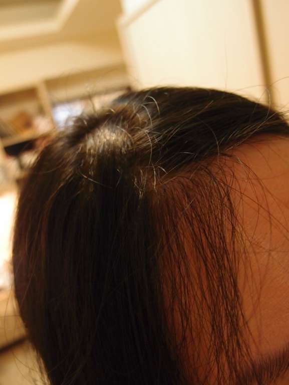 Charm卉紅生技頭皮護理精萃