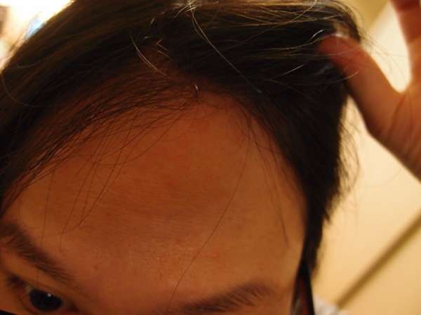 Charm卉紅生技頭皮護理精萃