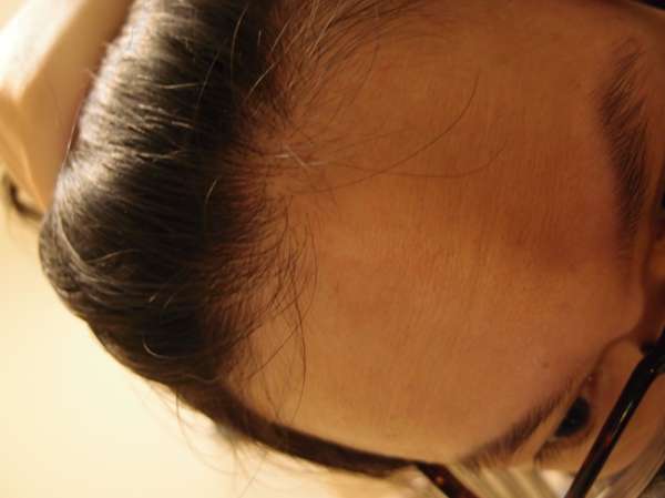 Charm卉紅生技頭皮護理精萃