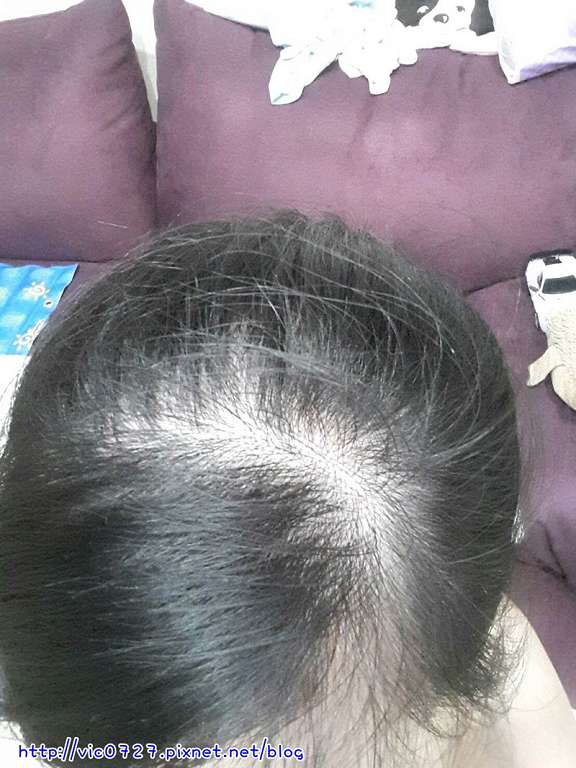 Charm卉紅生技頭皮護理精萃