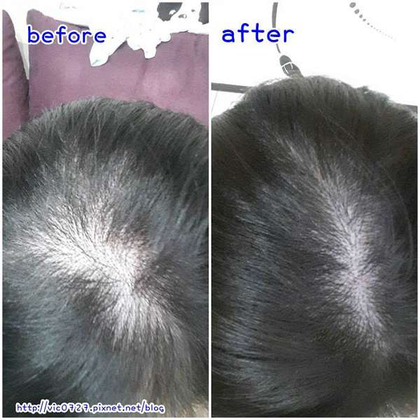 Charm卉紅生技頭皮護理精萃