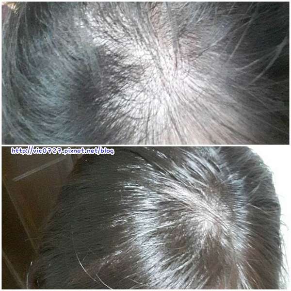 Charm卉紅生技頭皮護理精萃