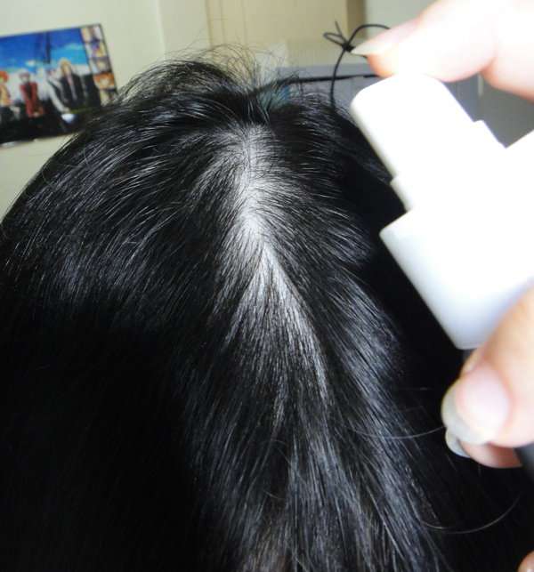 女人 知己 試用 大隊 Charm 卉紅 生技 頭皮 護理 精萃 掉頭髮 頭皮出油 髮量少 頭皮痛 頭皮長痘痘 圓形禿 雄性禿 頭髮變細 髮量少露出頭皮 脂漏性毛囊炎 染髮後頭皮發炎 chialo