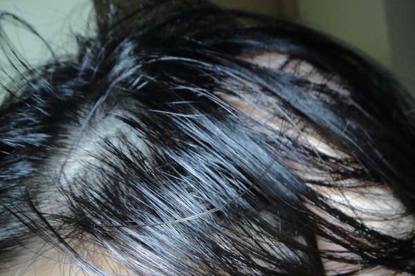 女人 知己 試用 大隊 Charm 卉紅 生技 頭皮 護理 精萃 掉頭髮 頭皮出油 髮量少 頭皮痛 頭皮長痘痘 圓形禿 雄性禿 頭髮變細 髮量少露出頭皮 脂漏性毛囊炎 染髮後頭皮發炎 chialo