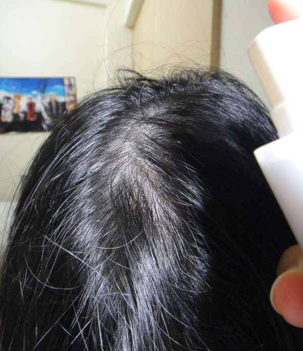 女人 知己 試用 大隊 Charm 卉紅 生技 頭皮 護理 精萃 掉頭髮 頭皮出油 髮量少 頭皮痛 頭皮長痘痘 圓形禿 雄性禿 頭髮變細 髮量少露出頭皮 脂漏性毛囊炎 染髮後頭皮發炎 chialo