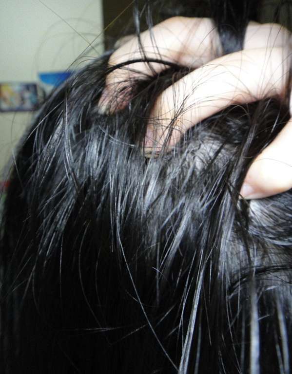 女人 知己 試用 大隊 Charm 卉紅 生技 頭皮 護理 精萃 掉頭髮 頭皮出油 髮量少 頭皮痛 頭皮長痘痘 圓形禿 雄性禿 頭髮變細 髮量少露出頭皮 脂漏性毛囊炎 染髮後頭皮發炎 chialo