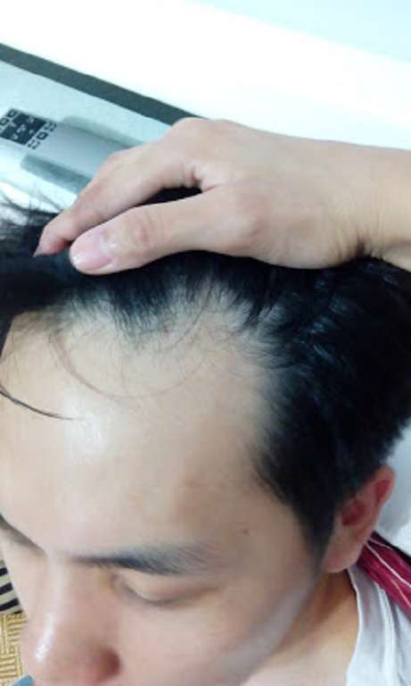 Charm卉紅生技頭皮護理精萃