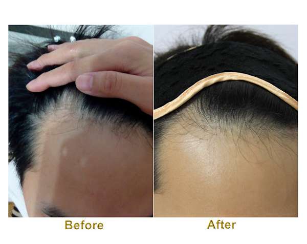 Charm卉紅生技頭皮護理精萃