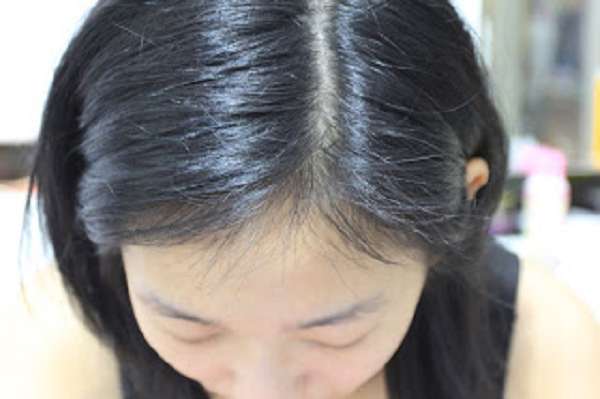 Charm卉紅生技頭皮護理精萃