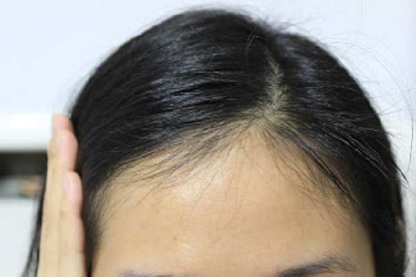 Charm卉紅生技頭皮護理精萃