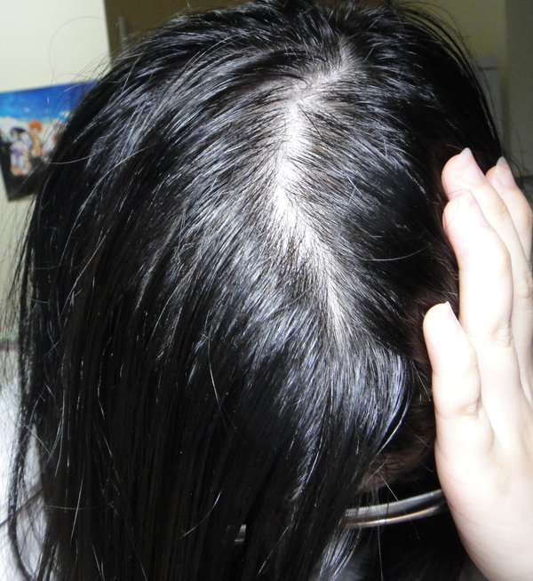 女人 知己 試用 大隊 Charm 卉紅 生技 頭皮 護理 精萃 掉頭髮 頭皮出油 髮量少 頭皮痛 頭皮長痘痘 圓形禿 雄性禿 頭髮變細 髮量少露出頭皮 脂漏性毛囊炎 染髮後頭皮發炎 chialo