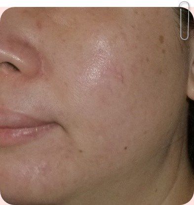  YouDo法國蝸牛保濕修護肌齡水凝乳