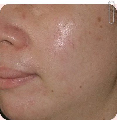  YouDo法國蝸牛保濕修護肌齡水凝乳