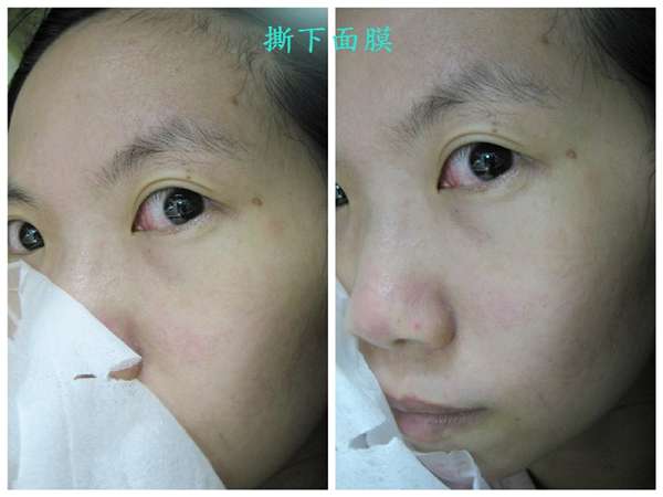 勻朵Young靚妍瞬效保濕面膜